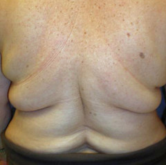 #TBT – Back Fat
